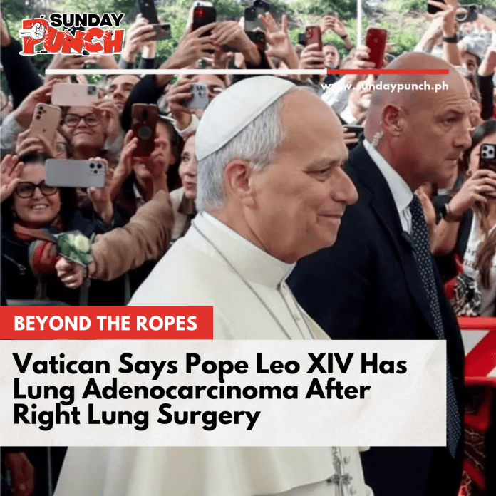 SP (78)